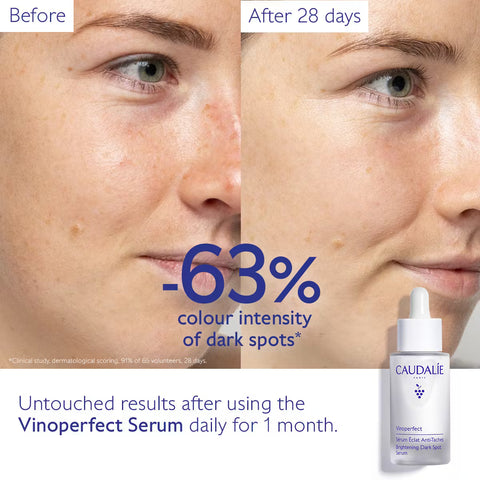 Caudalie | Vinoperfect Radiance Anti-Dark Spot Radiance Serum