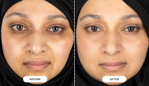 CurrentBody Skin | LED Light Therapy Face Mask