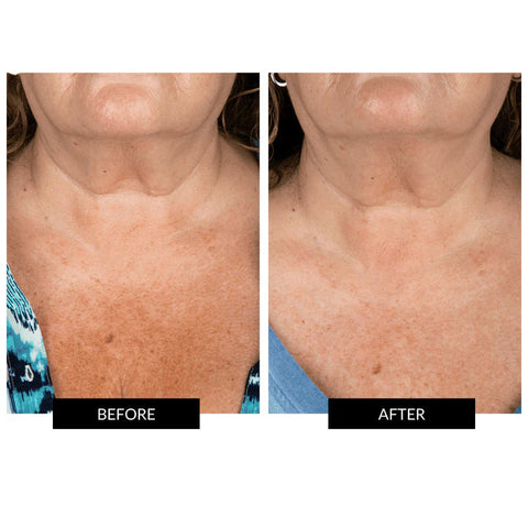 CurrentBody Skin | Neck & Decolletage Kit