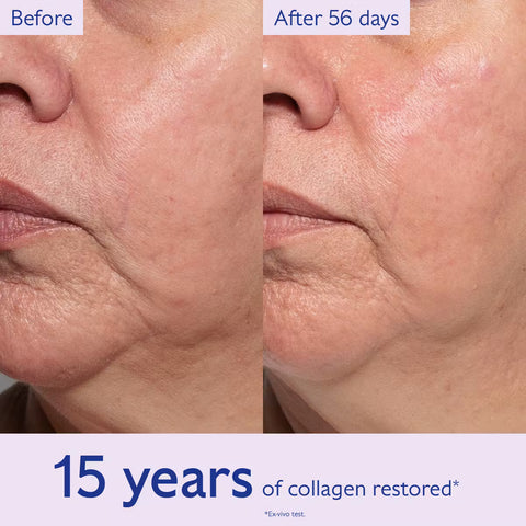 Before-and-after comparison of a person's lower face and neck showing skin texture and wrinkle improvement after 56 days, with text reading 'Before', 'After 56 days', and '15 years of collagen restored'.