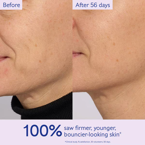 Before-and-after skin comparison showing the side of a person's face and neck, with visible texture and blemishes on the left and smoother, clearer skin on the right. Text at the top reads 'Before' and 'After 56 days,' and a banner at the bottom says '100% saw firmer, younger, bouncier-looking skin.
