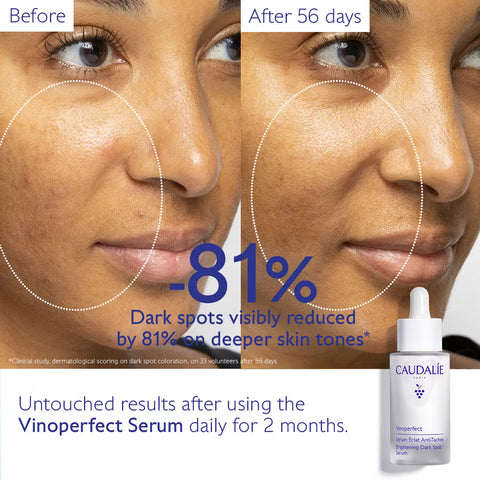 Caudalie | Vinoperfect Radiance  Anti-Dark Spot Radiance Serum