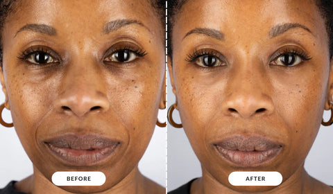 CurrentBody Skin | LED Light Therapy Face Mask
