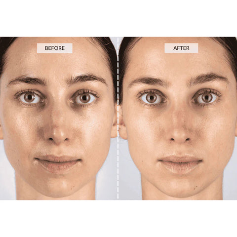 CurrentBody Skin | LED Light Therapy Face Mask