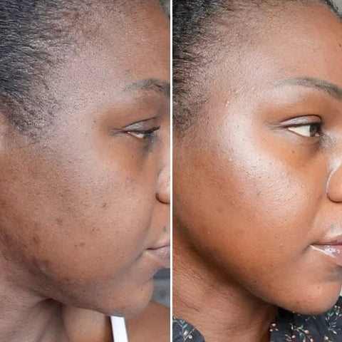 CurrentBody Skin | LED Red Light Therapy Face Mask: Series 2