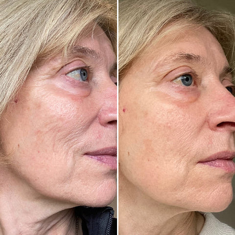 CurrentBody Skin | LED Red Light Therapy Face Mask: Series 2