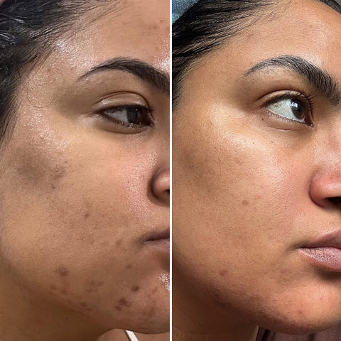 CurrentBody Skin | LED Red Light Therapy Face Mask: Series 2